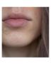 australian_bodycare_pimple_patches